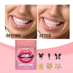 Crystal Dental Drill, Personality Sparkle Stylish Dental Accessories Enhance Smile Easily Use Decorative Dental Drill