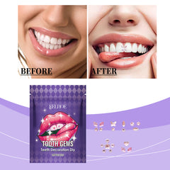 Dental Diamond Trim, Shine Beauty Stickers To Enhance Smile Brightness Lasting Easy Fit For All Tooth Types